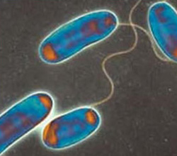 Ambiplaga: Control de Legionella